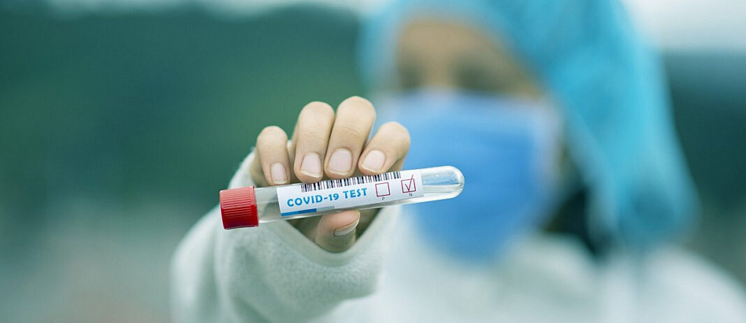 Naučnici izumili test krvi koji predviđa hoćete li umrijeti od korone