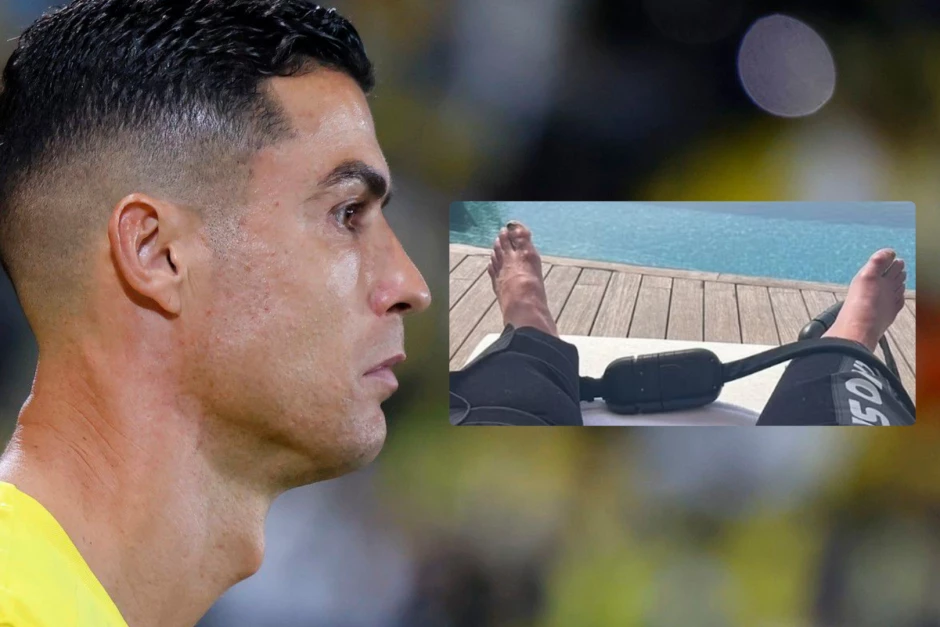 Ronaldo objavio fotografiju svojih stopala i zgrozio fanove. Tvoja stopala izgledaju užasno!