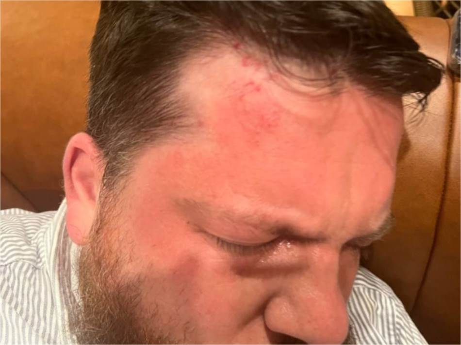 Napadnut bliski saradnik Navaljnog. Poprskao ga suzavcem pa udario čekićem u glavu