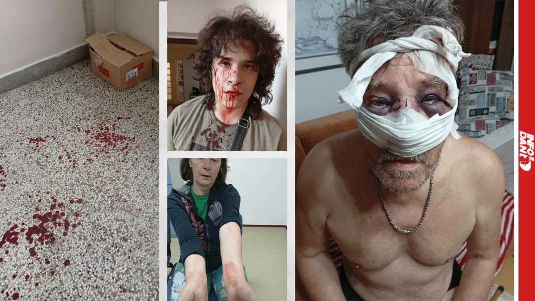Tuzla, MUP TK, brutalna tuča, Slatina, policija, hapšenje, teška tjelesna povreda, Kantonalno tužilaštvo TK, crna hronika, Bosna i Hercegovina
